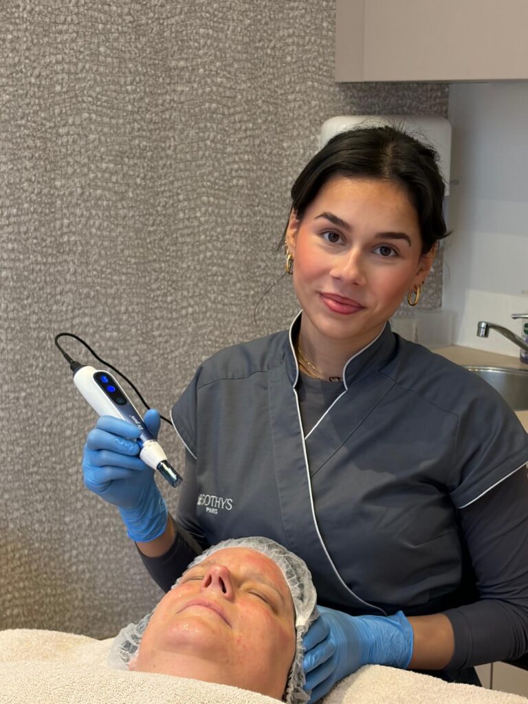 Microneedling tegen fijne lijntjes rimpels en vale huid stimuleert collageen en elastine aanmaak