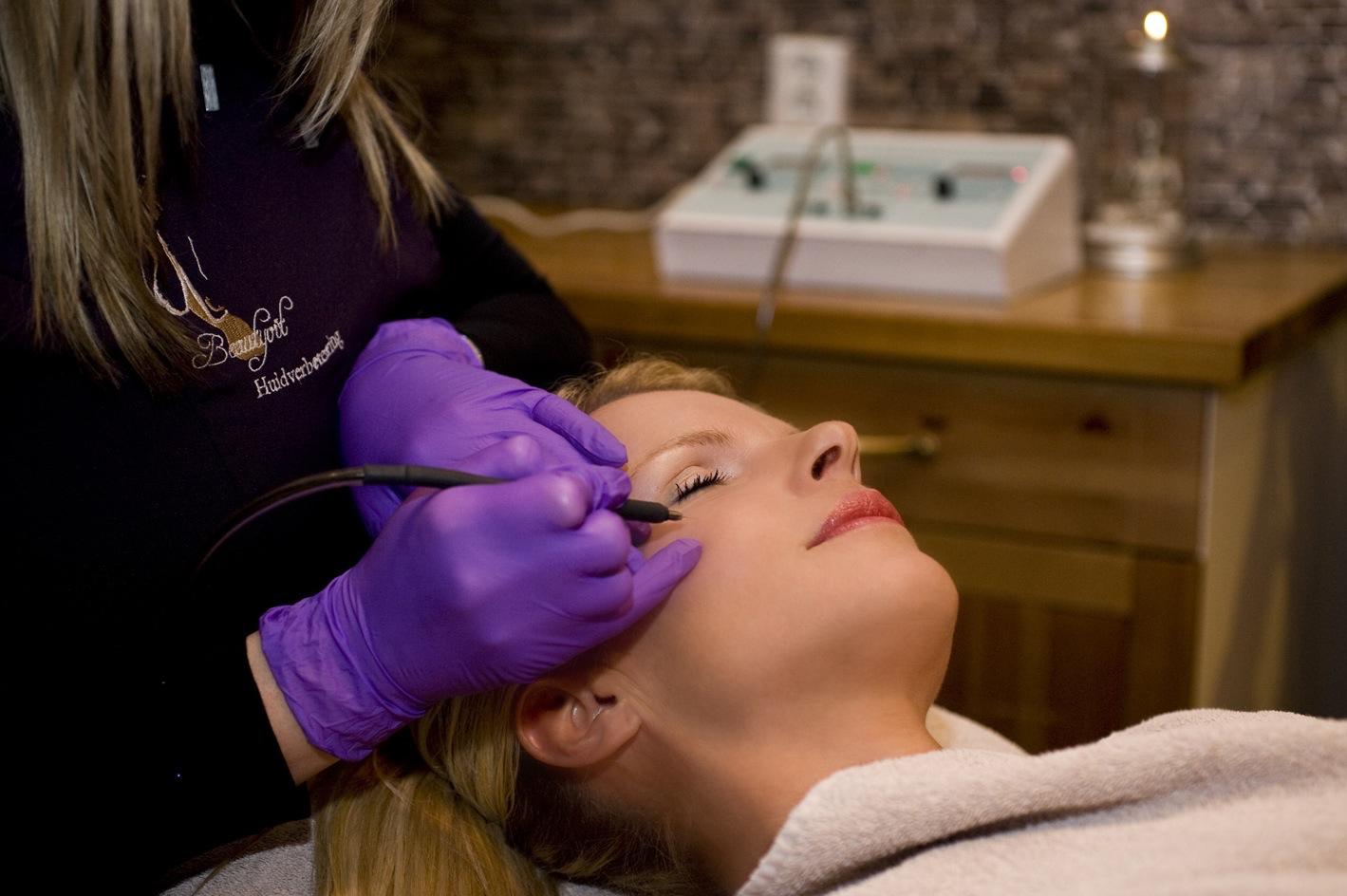 Huidwoekeringen huidoneffenheden couperose steelwratjes ouderdomswratjes verwijderen Breda Beautyvit Huidverbetering