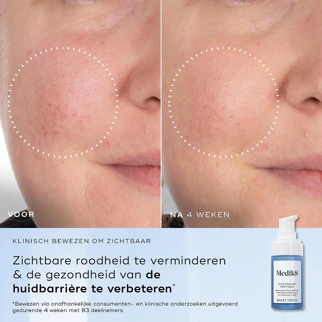 Niacinamide Peptides - Afbeelding 4